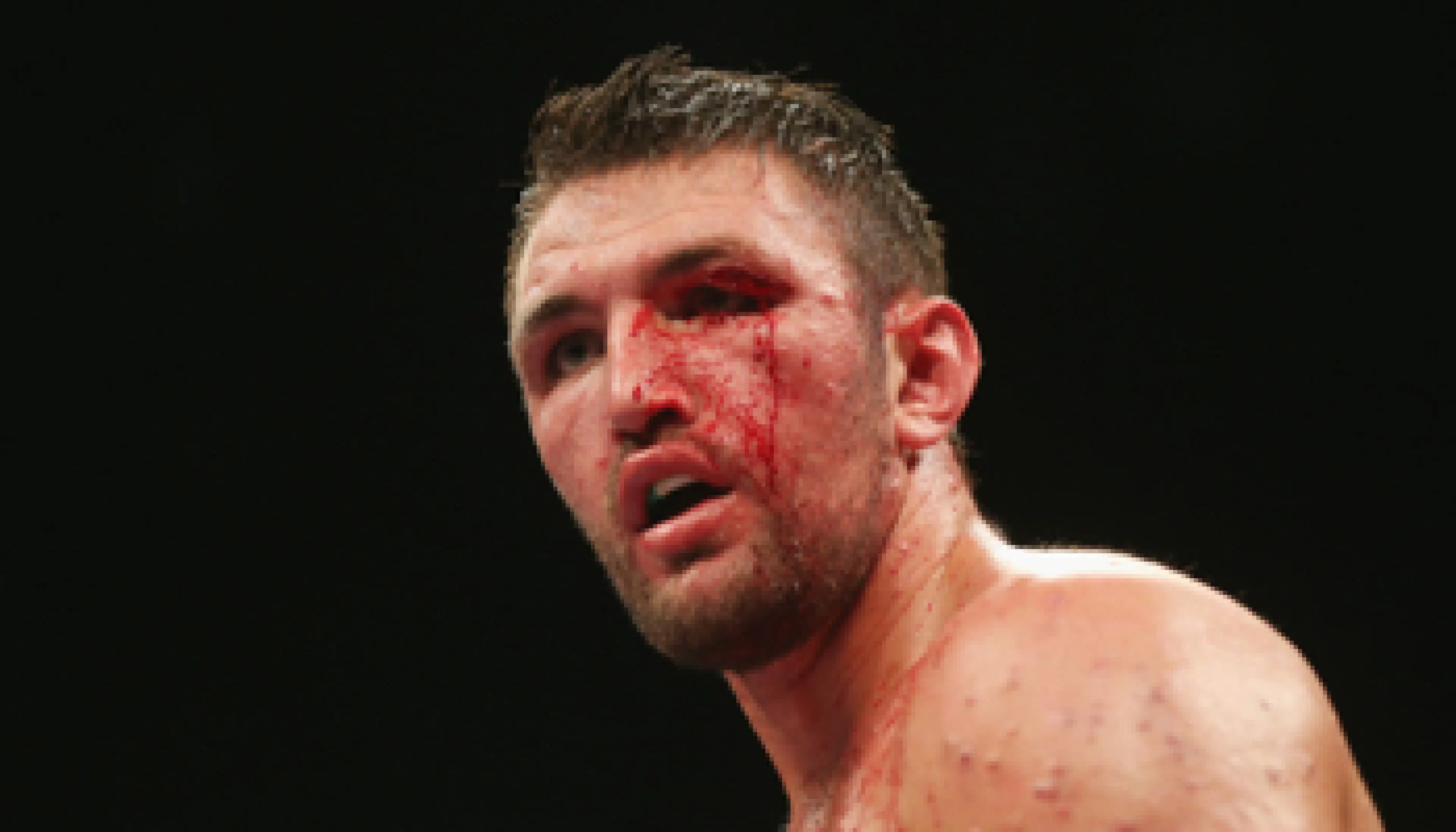 Hughie Fury (ENG) - Samuel Peter (NGR)