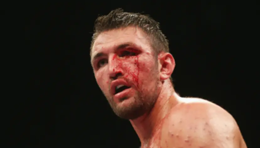 Hughie Fury (ENG) - Samuel Peter (NGR)